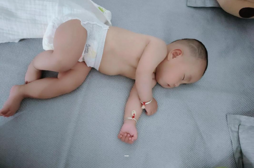 永城孕妇前庭大腺囊肿